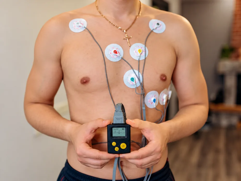 Paziente con elettrodi applicati al torace e collegati a un dispositivo Holter portatile per il monitoraggio dell'attività elettrica del cuore.
